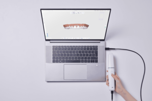i900 Intraoral Scanner & HP Laptop Package (Medit)