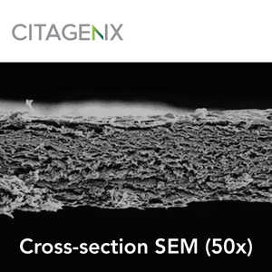 Neomem Flexplus Barrier membrane | Xenograft | Resorbable 