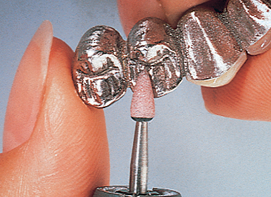 Lab Series Stones (Shofu)