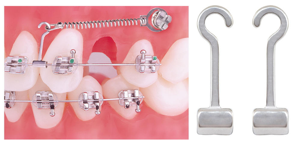 Molar Bands & Tubes